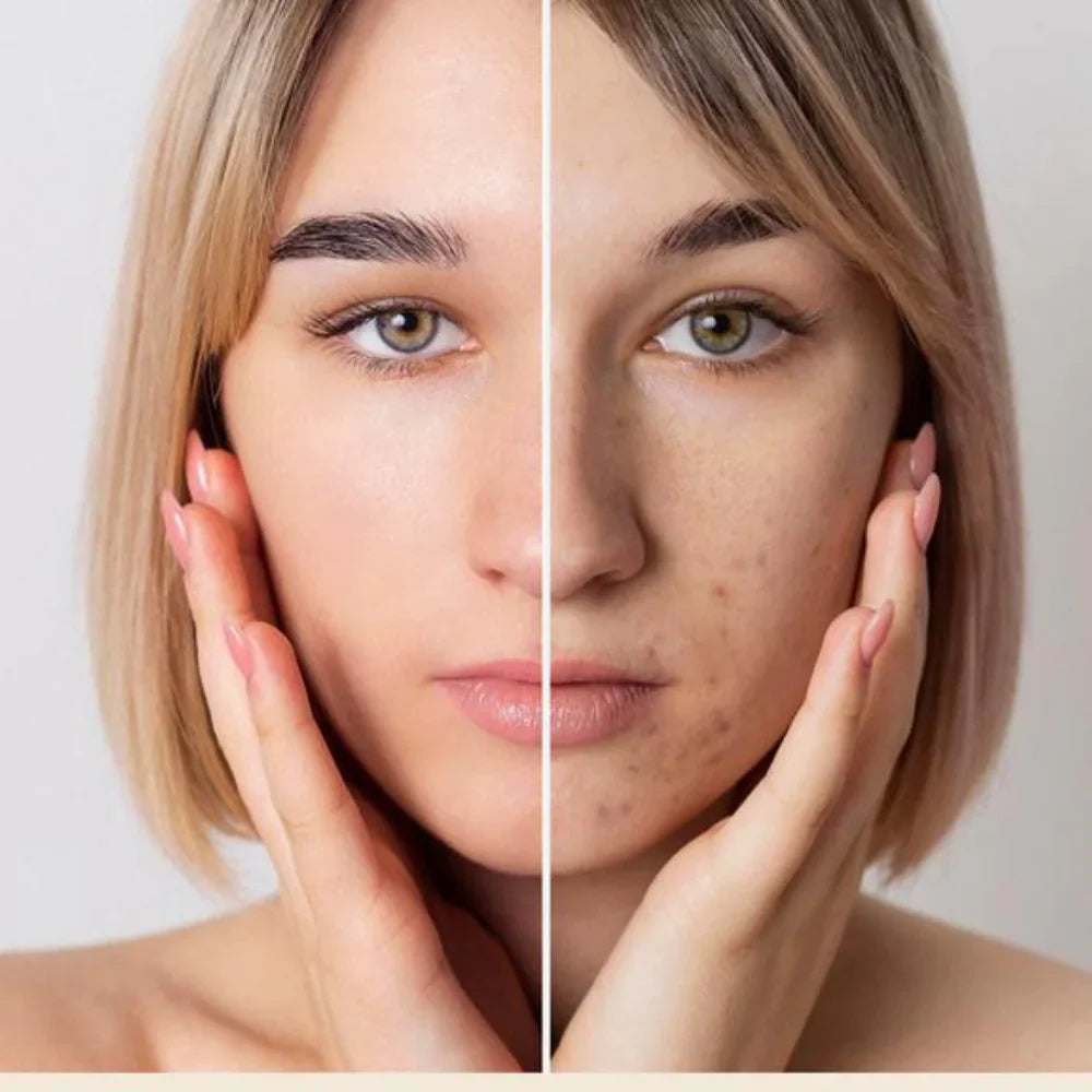 Why Your Skincare Is Breaking You Out (And How Water-Based Formulas Fix It)